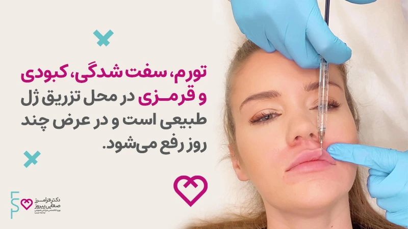 عوارض تزریق ژل ژوویدرم