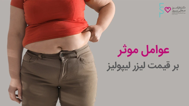 عوامل موثر بر قیمت لیزر لیپولیز