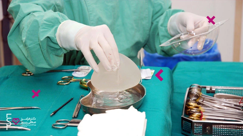 هزینه پروتز سینه و انواع پروتز سینه