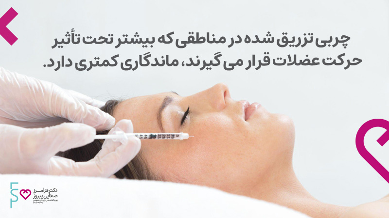 دوره ماندگاری تزریق چربی