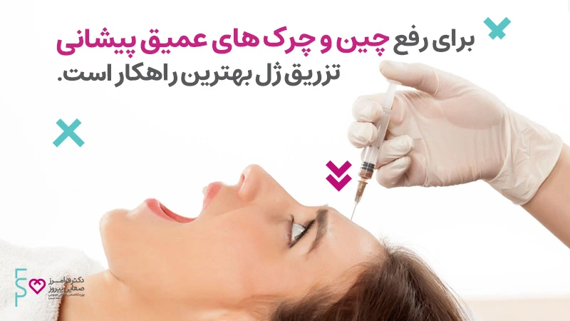 فیلر پیشانی رفع چروک پیشانی