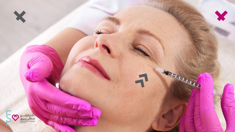 هرآنچه نیاز است درباره تزریق ژل آلیاکسین بدانید