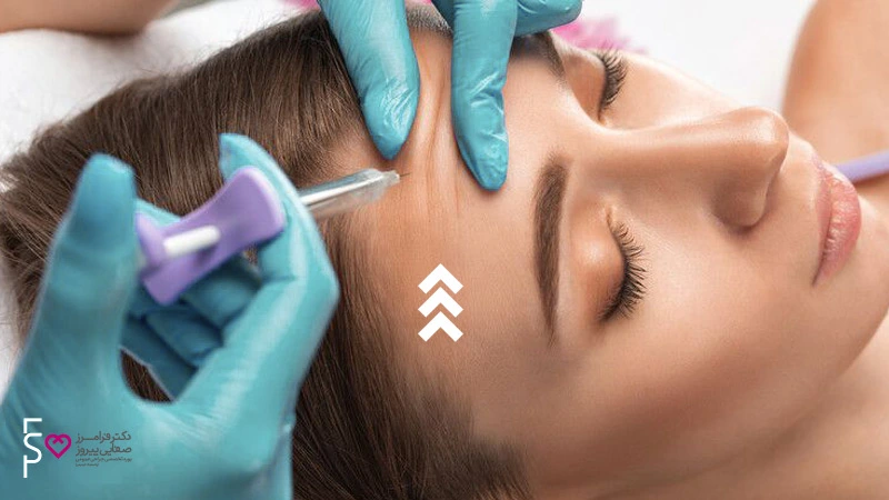 ژل ژوویدرم اولترا