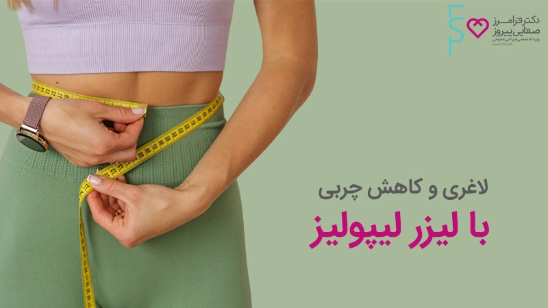لاغری و کاهش چربی در بدن با لیزر لیپولیز