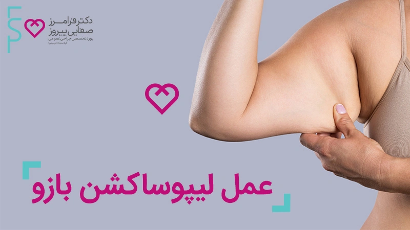 لیپوساکشن بازو 2