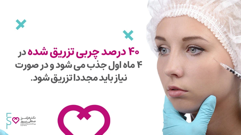 ماندگاری تزریق چربی به گودی زیر چشم