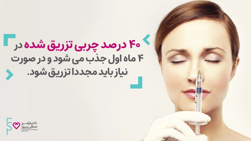ماندگاری تزریق چربی زیر چشم