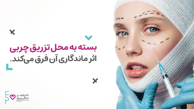 دوره ماندگاری تزریق چربی