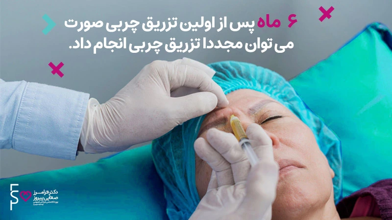 سوالات متداول تزریق چربی
