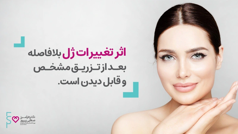 ماندگاری تزریق ژل و اثر تغییرات آن