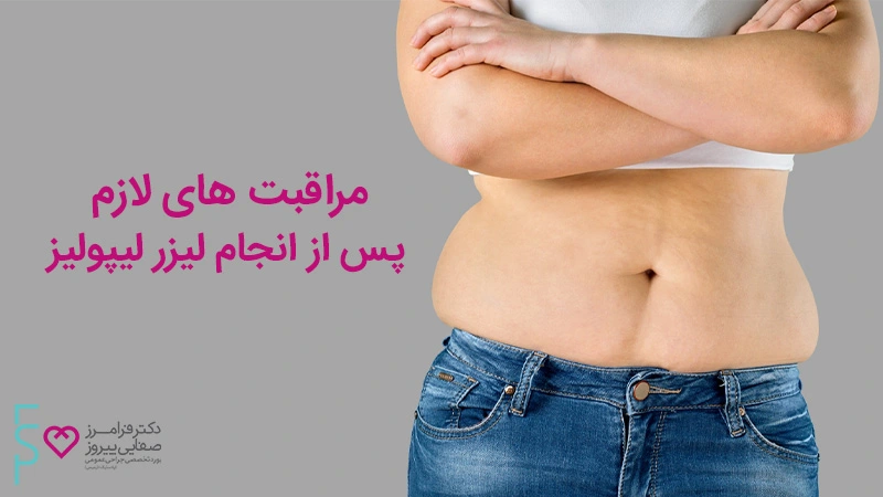 مراقبت های لازم پس از انجام لیزر لیپولیز