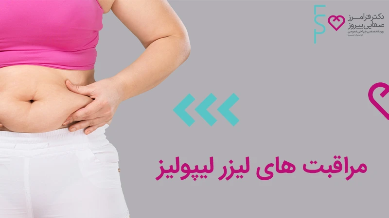 مراقبت های لیزر لیپولیز