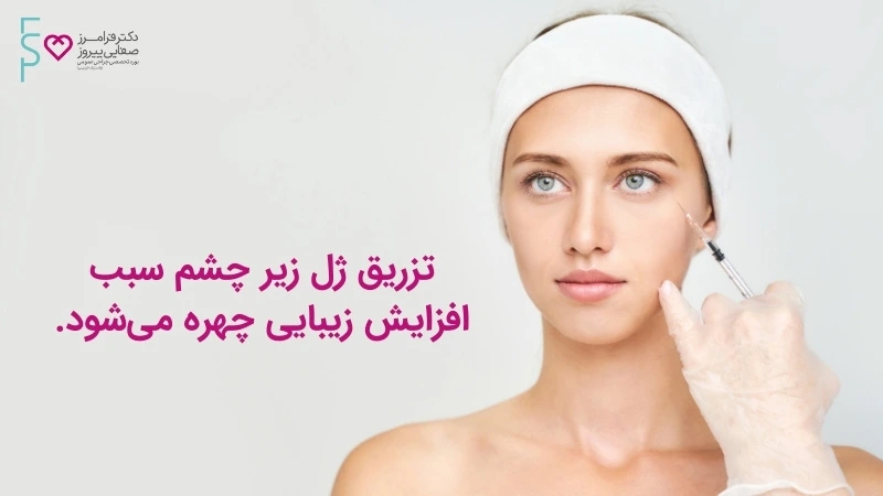 مزایای تزریق ژل زیر چشم