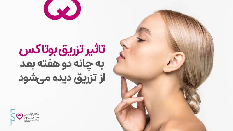 نحوه تزریق بوتاکس چانه