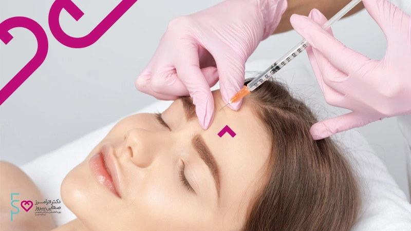 تزریق ژل پیشانی برای رفع خطوط و چروک روی پیشانی