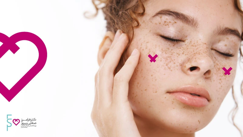 گونه گذاری با تزریق چربی