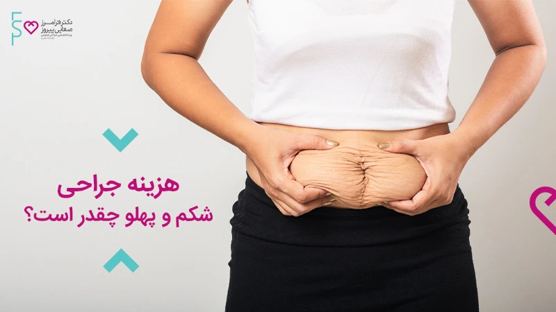 هزینه جراحی شکم و پهلو چقدر است