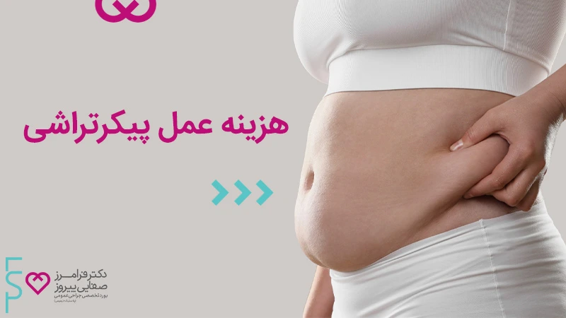 هزینه عمل پیکر تراشی