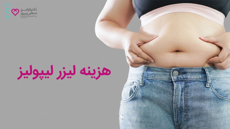هزینه لیزر لیپولیز