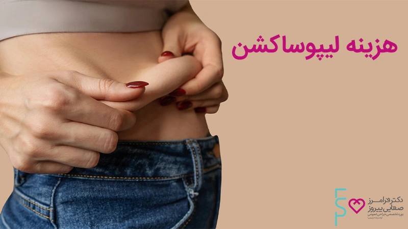هزینه لیپوساکشن