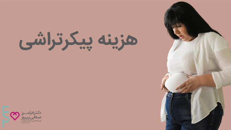 هزینه عمل پیکرتراشی