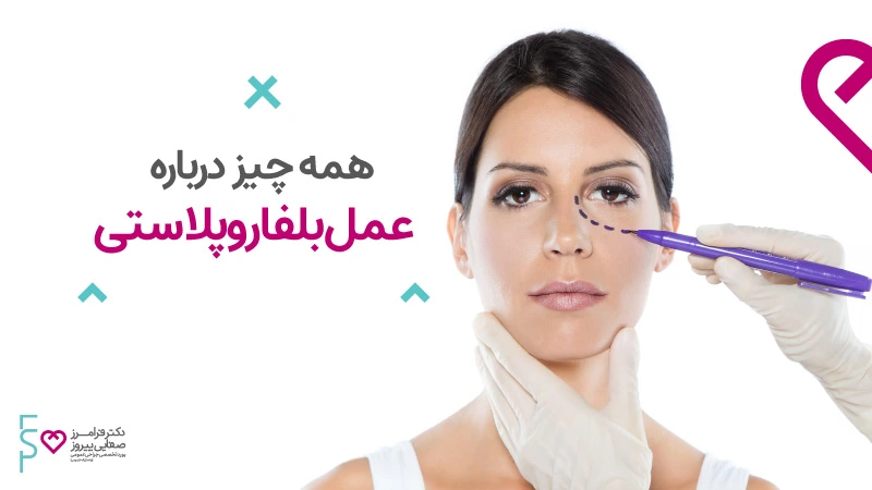 همه چیز درباره عمل بلفاروپلاستی