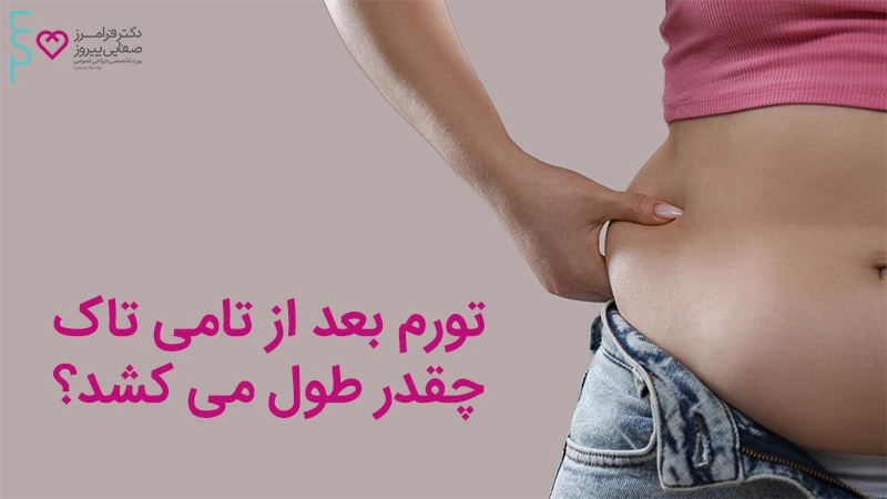 ورم بعد از تامی تاک چقدر طول می کشد