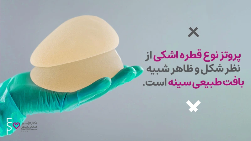 هزینه پروتز سینه و انواع پروتز سینه