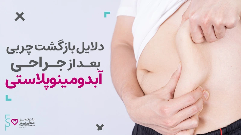 چند دلیل بازگشت چربی بعد از جراحی آبدومینوپلاستی