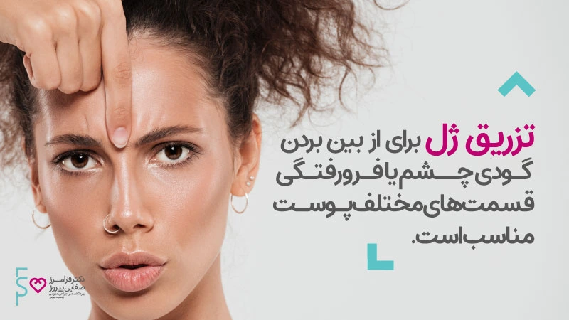چه موقع تزریق ژل نیاز است