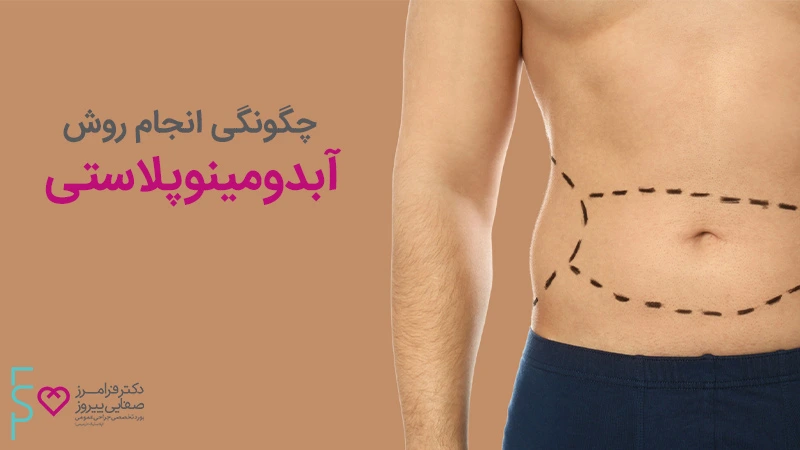 جراحی آبدومینوپلاستی و زیبایی شکم