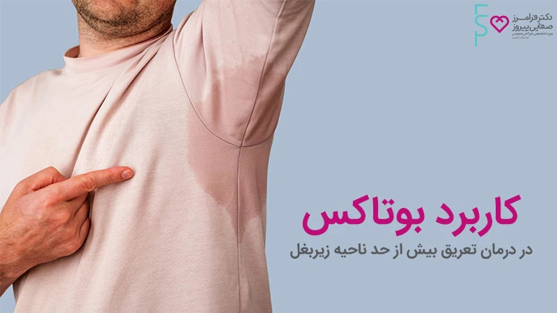 در کنترل تعريق زیر بغل بوتاکس تاثیر دارد؟