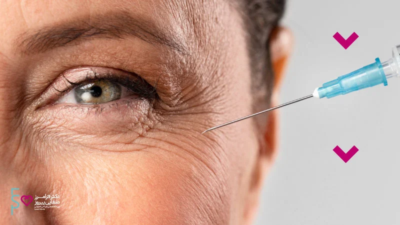 جوانسازی پوست با روش PRP