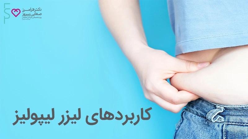 آشنایی با دستگاه لیزر لیپولیز پیشرفته Lipotherme