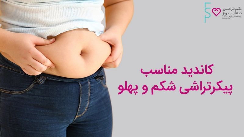 کاندید مناسب پیکرتراشی شکم و پهلو