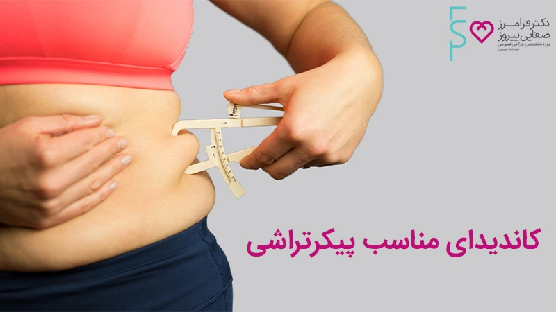 کاندیدای مناسب پیکرتراشی