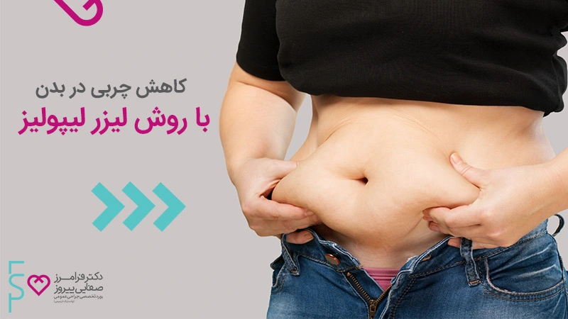 کاهش چربی در بدن با روش لیزر لیپولیز