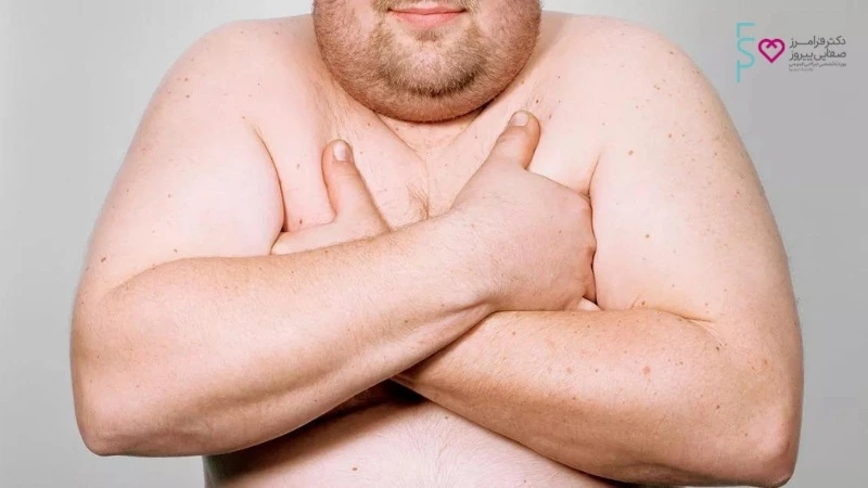 ژنیکوماستی چیست؟ (بزرگی سینه در آقایان)