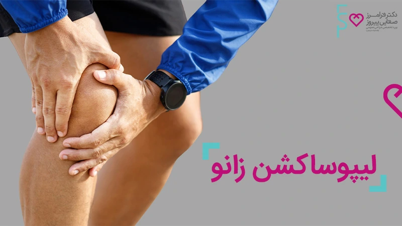 لیپوساکشن زانو