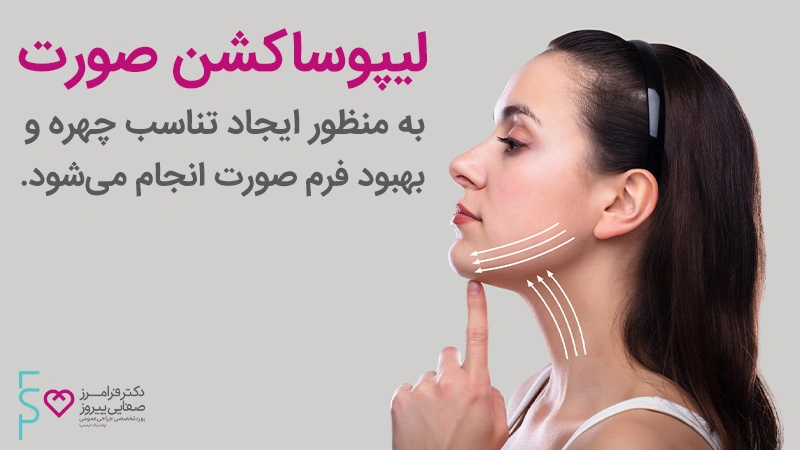 عمل لیپوساکشن صورت