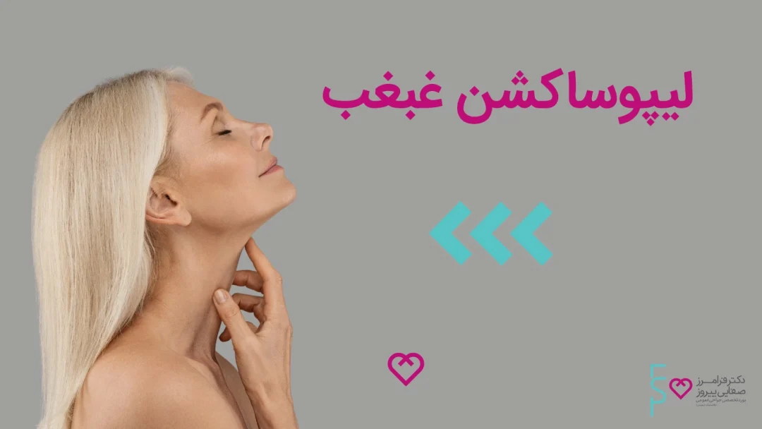 لیپوساکشن غبغب