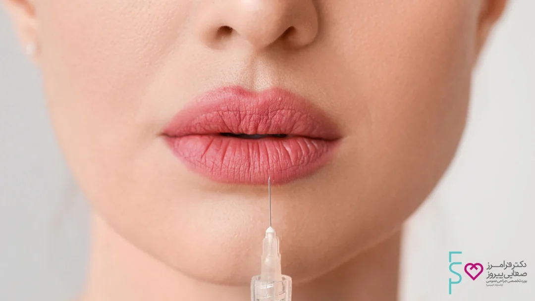 تزریق ژل و فیلر به لب
