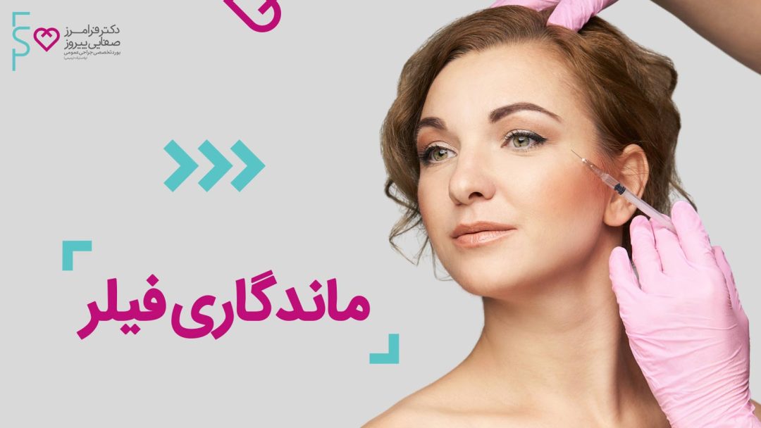 ماندگاری فیلر، عوامل تاثیرگذار در ماندگاری ژل