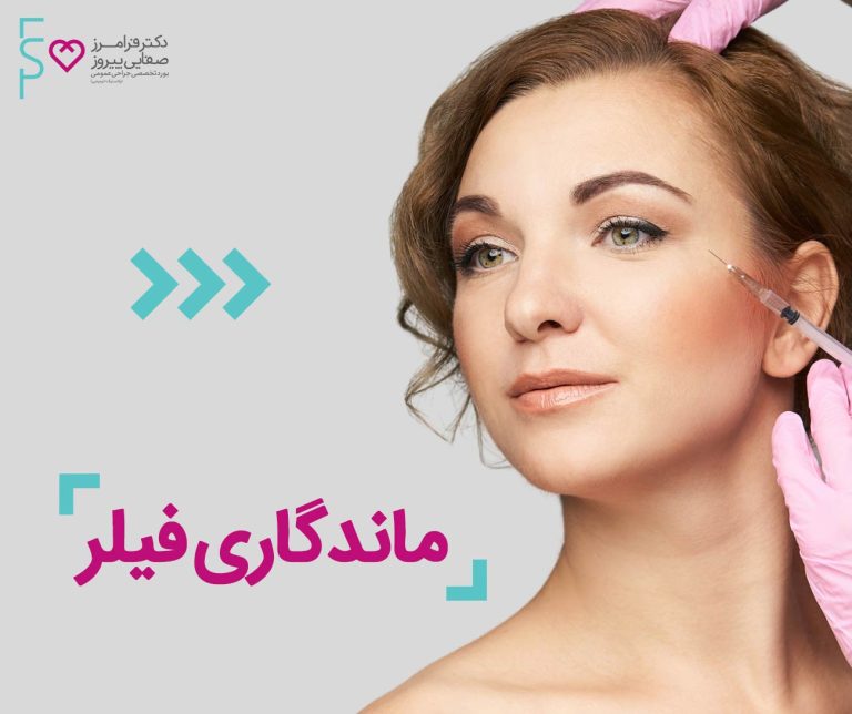 ماندگاری فیلر، عوامل تاثیرگذار، راههای افزایش ماندگاری ژل