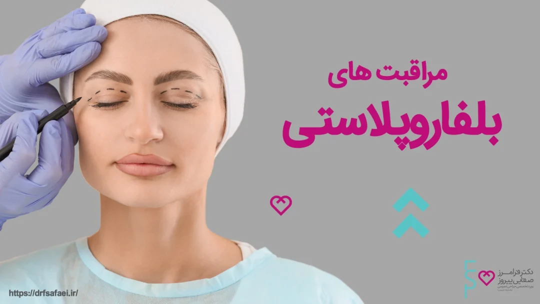 مراقبت های بلفاروپلاستی