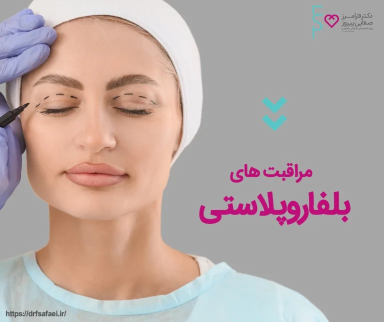 مراقبت های قبل و بعد بلفاروپلاستی