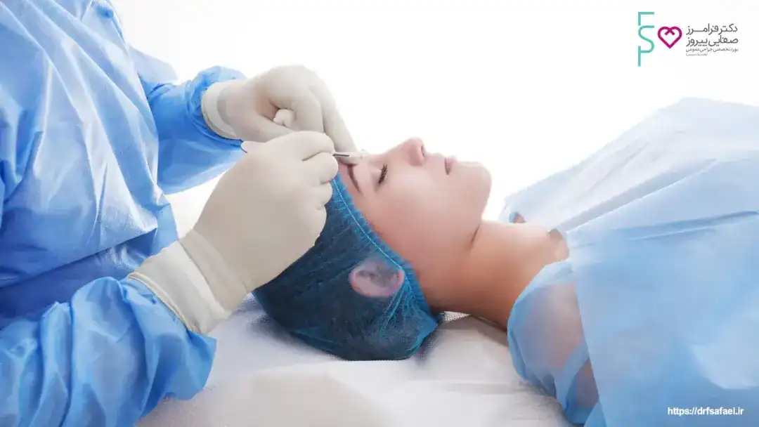 بایدها و نباید های بلفاروپلاستی