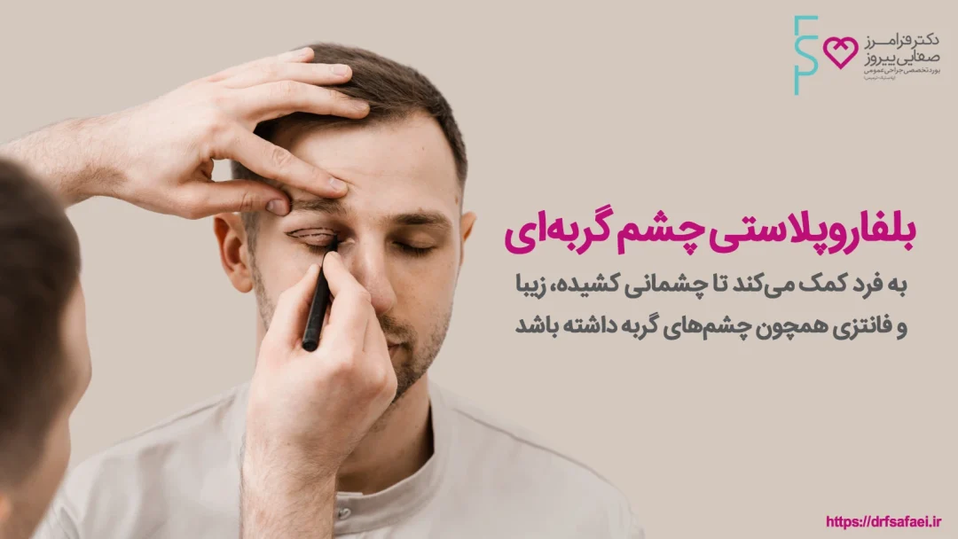 بلفاروپلاستی چشم گربه ای