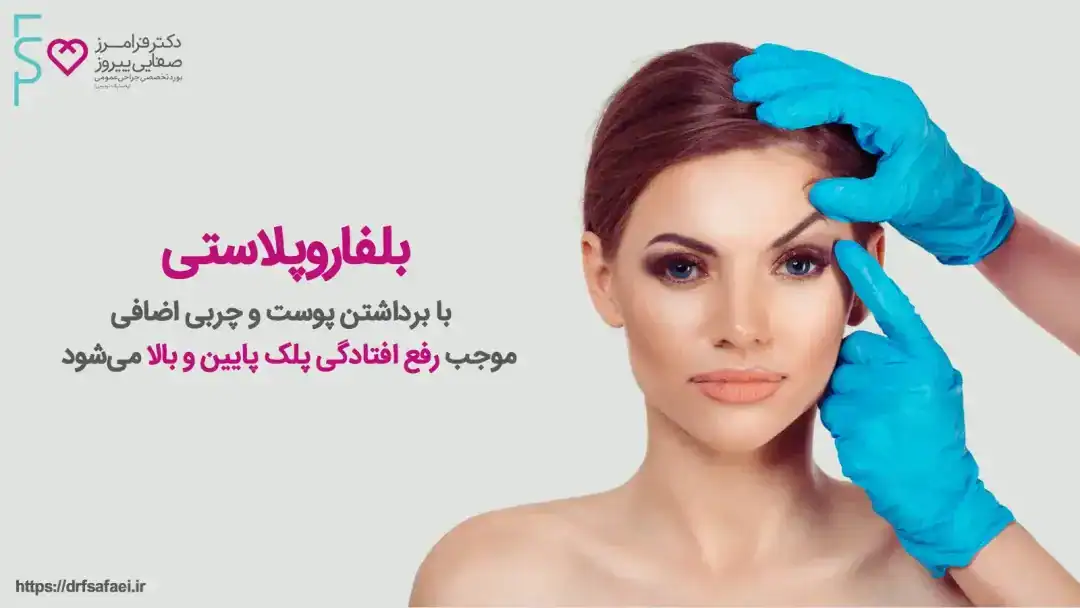 راههای کاهش عوارض بلفاروپلاستی