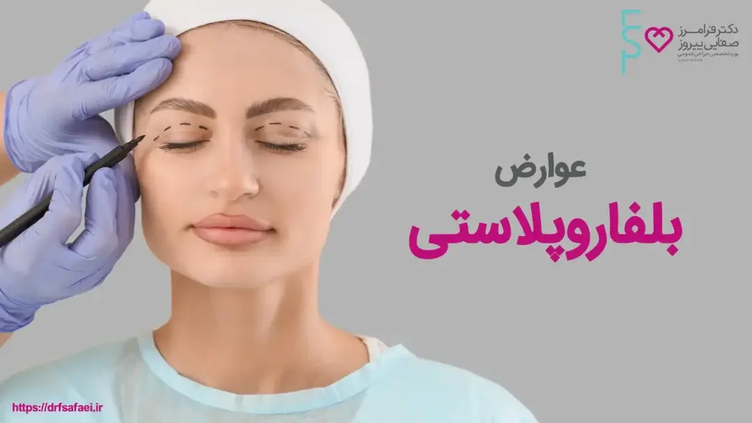 عوارض بلفاروپلاستی و راههای کاهش آن با دکتر صفایی